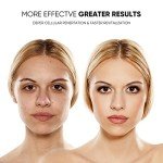 GOHIGK LED Light Therapy Facial Mask Device