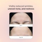 Solawave Red Light Therapy Device for Skin Rejuvenation