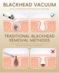 Blackhead Remover Vacuum with 3 Suction Levels
