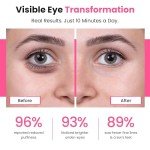 Bèa Eye Revitalize – Red Light Therapy for Eyes