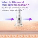 UNOISETION 3-in-1 Microdermabrasion Skin Care Device