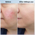 Vcycal Facial Massager: Hot & Cold Skin Tool