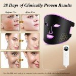 YOEYOU Rechargeable Red Light Therapy Face Mask