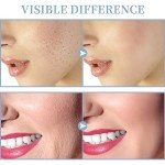 TUMAKOU Portable High Frequency Facial Wand Machine