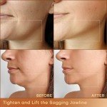 MLAY RF Beauty Machine for At-Home Skin Tightening