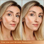 MLAY RF Beauty Machine for At-Home Skin Tightening