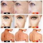 7-in-1 Portable Light Therapy Device for Skin