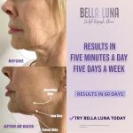 5-in-1 Microcurrent Facial Device for Skin Lifting