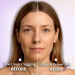 5-in-1 Microcurrent Facial Device for Skin Lifting