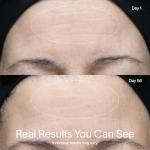 Solawave Red Light Therapy Device for Skin Rejuvenation