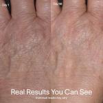 Solawave Red Light Therapy Device for Skin Rejuvenation