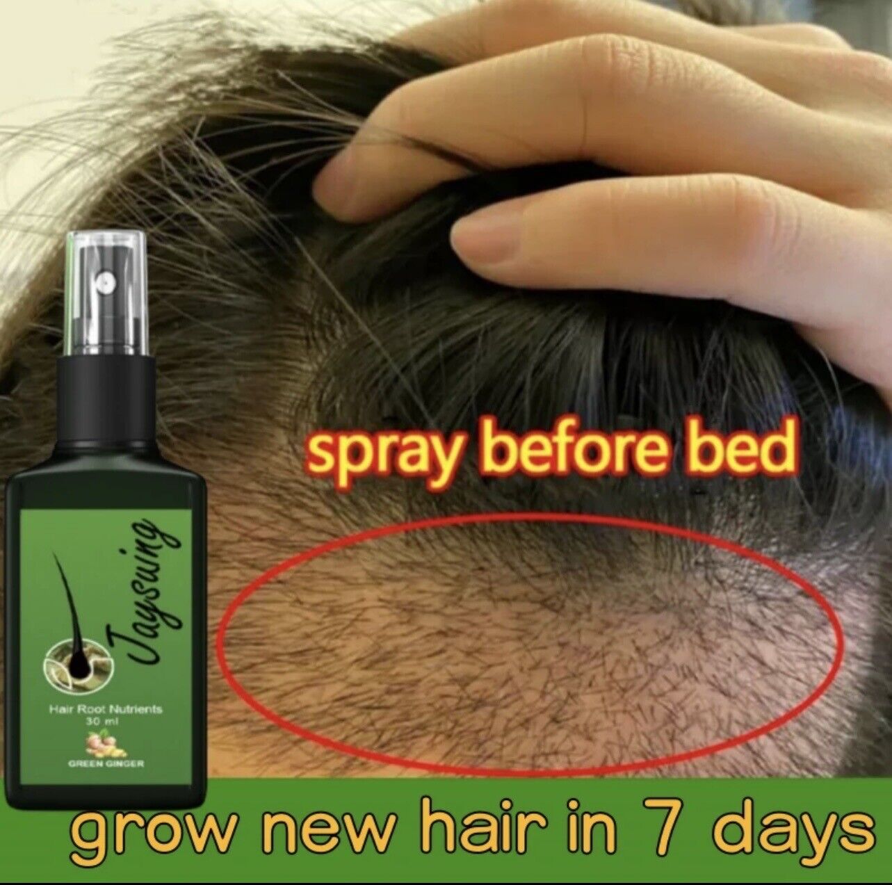 Effective Hair Loss Solutions and Treatments