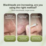 LANBENA Charcoal Peel Off Blackhead Remover Mask
