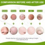 Charcoal Peel-Off Blackhead Remover Face Mask
