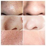 LANBENA Green Tea Blackhead Remover Peel-Off Mask