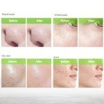 Charcoal Peel Off Blackhead Remover Mask 2.7 oz