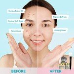 Deep Cleansing Clay Mask Set for Glowing Skin