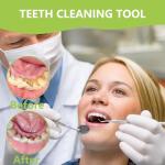 PARYUNGR Dental Tools, Professional Teeth Cleaning Oral Care Hygiene Kit, Stainless Steel Dental Pick Tooth Scraper Tartar Plaque Remover for Dentist, Personal, Pet Use with Storage Box