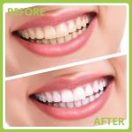 PARYUNGR Dental Tools, Professional Teeth Cleaning Oral Care Hygiene Kit, Stainless Steel Dental Pick Tooth Scraper Tartar Plaque Remover for Dentist, Personal, Pet Use with Storage Box