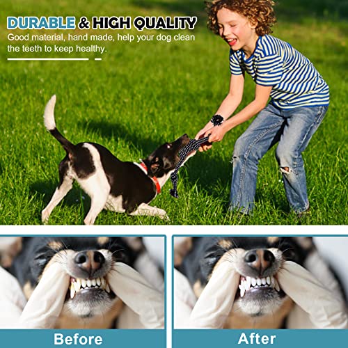 BUIBIIU Dog Toys, Dog Teething Toys Best Puppy Chew Toys Dog Chew Toys Squeaky Toys Balls