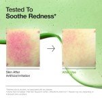 Anua Redness Soothing Serum with Azelaic Acid