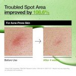 Anua Redness Soothing Serum with Azelaic Acid