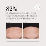 Naturium Azelaic Acid 10% Facial Treatment with Niacinamide