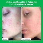 Paula's Choice 10% Azelaic Acid Brightening Serum