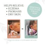 Unscented Whipped Tallow Balm for Eczema Relief