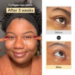 Korean Collagen Eye Patches for Dark Circles