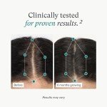 Nutrafol Women's Hair Growth Supplements for Thicker Hair