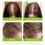 Svvimer Hair Growth Serum with Rosemary & Biotin