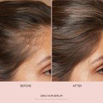 VEGAMOUR GRO Hair Serum for Thicker, Fuller Hair