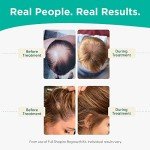 Shapiro MD Vegan Hair Loss Conditioner for Thinning Hair