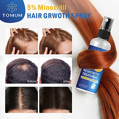 5% Minoxidil Hair Growth Spray for Men & Women