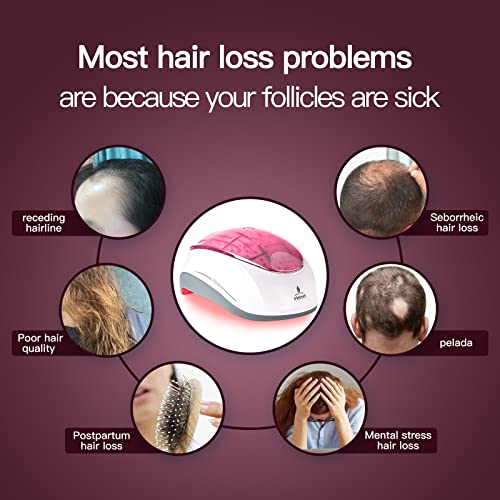 iHelmet Laser Hair Growth Therapy Cap for All