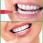 Dental Hygiene Kit: 350 Interdental Brushes & Picks