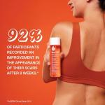 Bio-Oil Body Oil Serum for Scars and Stretch Marks