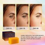 Kojic Acid Dark Spot Remover Soap Bars (2 Pack)