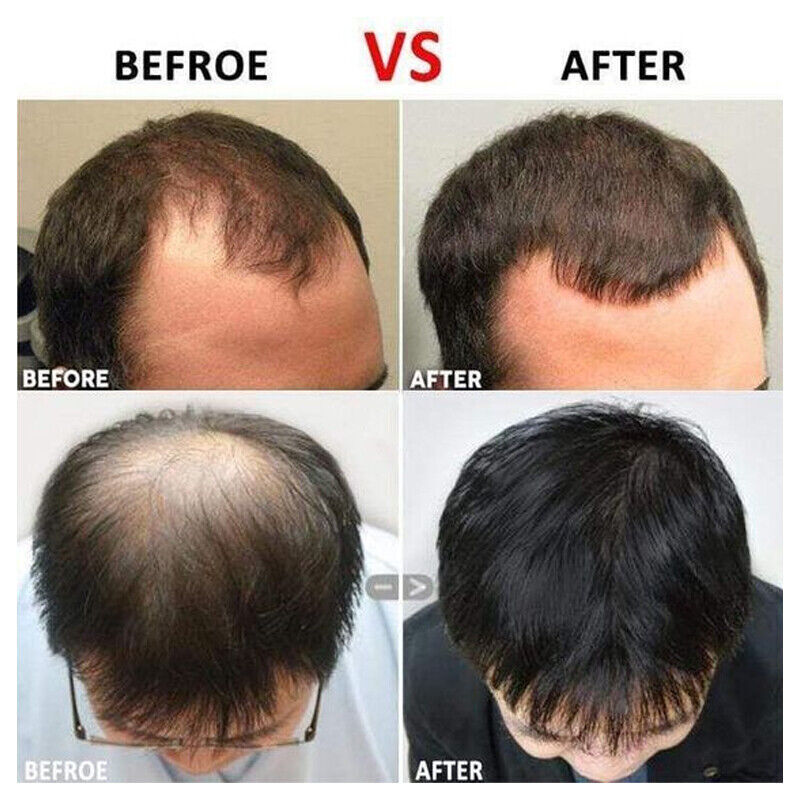 Hair Growth Vitamins for Men & Women - 60 Caps