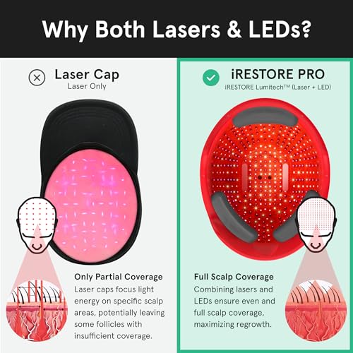 iRestore Laser Hair Growth System for Men & Women
