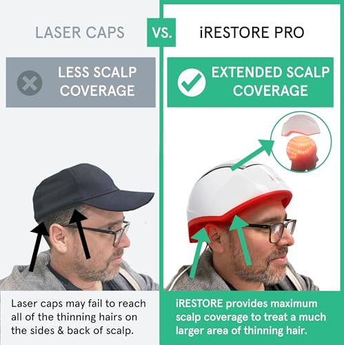 iRestore Laser Hair Growth System for Men & Women