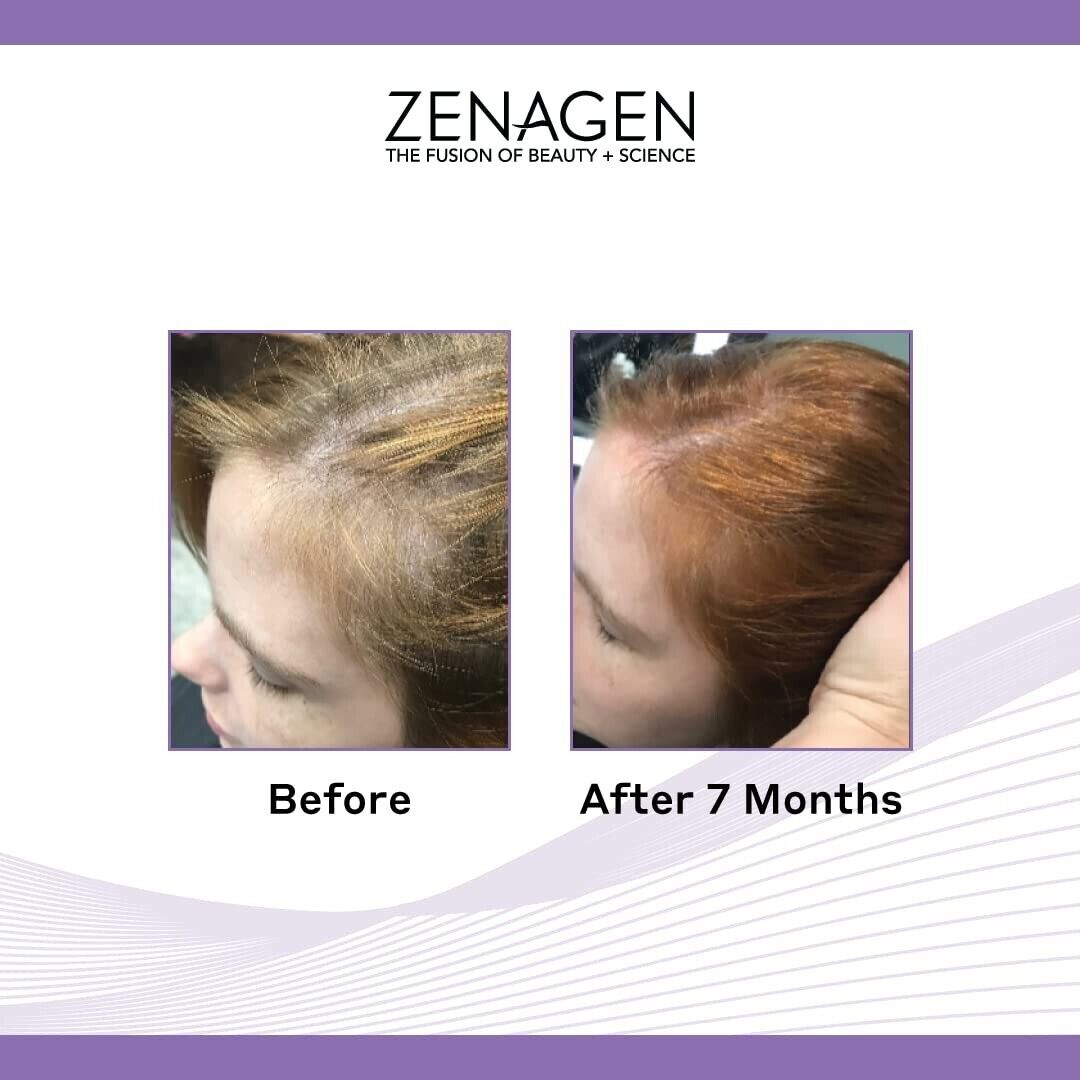 ZENAGEN REVOLVE Women's Hair Loss Thickening Shampoo