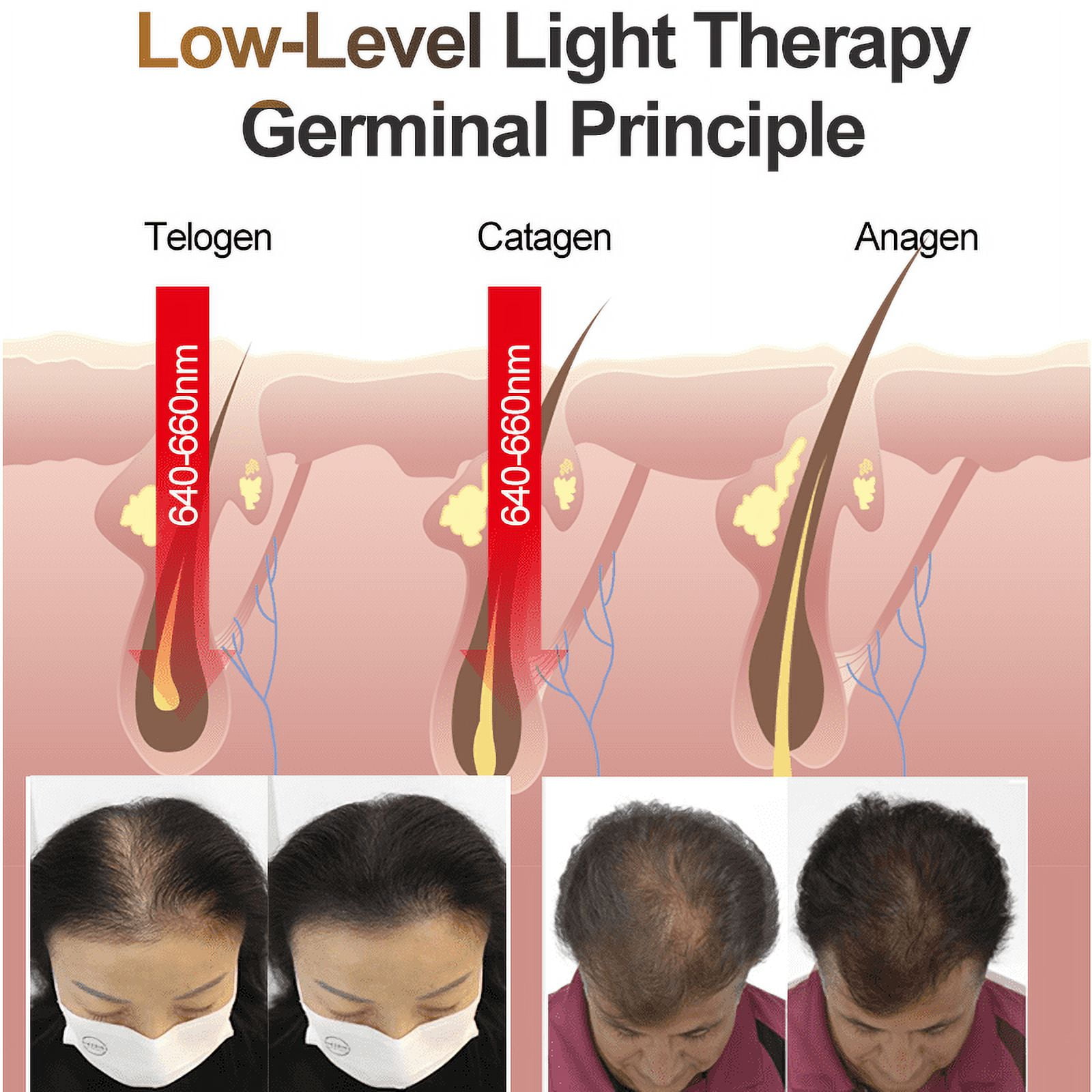 Lescolton Laser Hair Growth Helmet for Men & Women