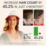 iRestore Laser Hair Growth System for Men & Women