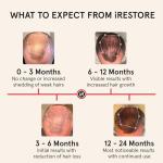 iRestore Laser Hair Growth System for Men & Women