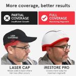 iRestore Laser Hair Growth System for Men & Women