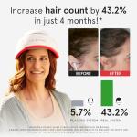 iRestore Laser Hair Growth System for Men & Women