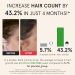 iRestore Laser Hair Growth System for Men & Women