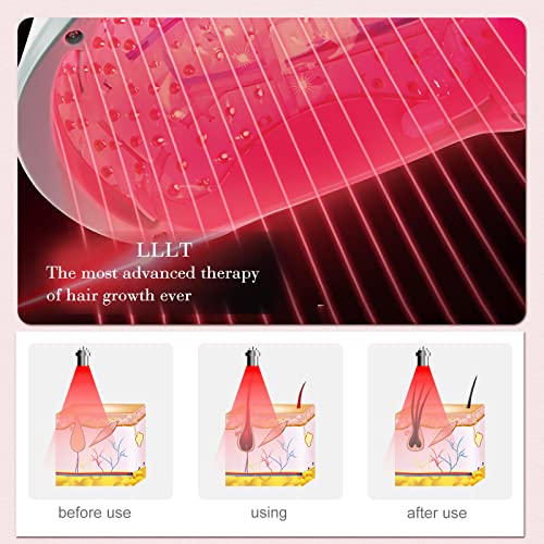 iHelmet Laser Hair Growth System for All